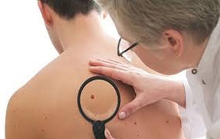 Рак кожи — группа злокачественных новообразований, сформированных из клеток кожи и соединительной ткани. Это одно из самых распространенных из всех онкозаболеваний.